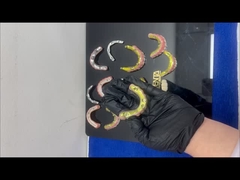 Υβριδική γέφυρα από ζιρκόνια