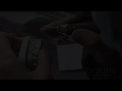 Οι Φανίρες Γκαραμπούλης Η τέλεια λύση για τις φυσικές διαφανείς οδοντικές φανίρες