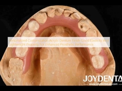 Προσαρμογή Προσαρμογή Ακρυλική οδοντοστοιχία Φινίρισμα Καλή ελαστικότητα και ελαφρύτητα για βελτιωμένες προσθετικές επιδόσεις