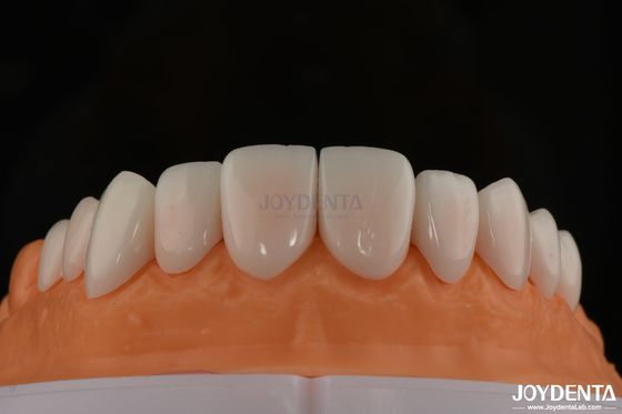 Αγορά Α1-Α4 Ips Emax Press Πορσελάνη Δοντιακές Φανιέρες Ανθεκτικές στα λεκέτα Προσαρμόσιμο σχήμα σε απευθείας σύνδεση κατασκευή