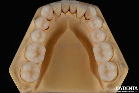 Αγορά 3D Πολυστρώμα Οδοντιατρική Πλήρης Ζιρκόνια Αντίσταση σε Τρίγματα Φυσική δομή δοντιών σε απευθείας σύνδεση κατασκευή