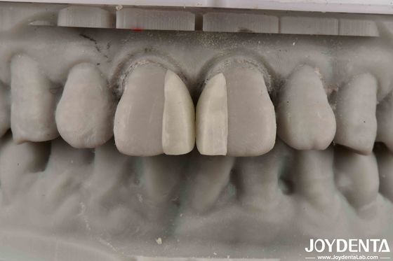 Αγορά Τυλιγμένες επιφάνειες Ανθεκτικότητα στη φωτιά Μικροελιές για εσωτερική διακόσμηση σε απευθείας σύνδεση κατασκευή