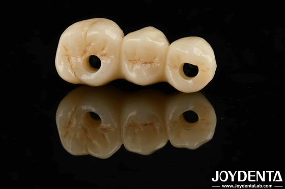 Αγορά Υψηλή αισθητική Υψηλή ελαστική αντοχή 1000 MPa Πλήρη ζιρκόνια για πρότυπα σε απευθείας σύνδεση κατασκευή