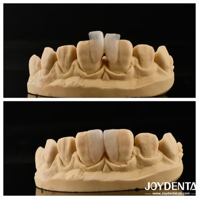 Αγορά Εύκολη στην εγκατάσταση Μικροφινέρη Τελική λύση για εσωτερική διακόσμηση πάχος 0,2 mm σε απευθείας σύνδεση κατασκευή