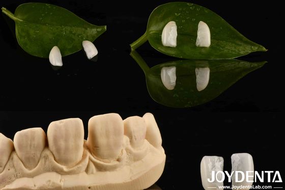 Αγορά Υψηλή αντοχή Υπερλεπτή μικροφινέρα με φυσικό ξύλο Δυνατότητα 0,2 mm σε απευθείας σύνδεση κατασκευή