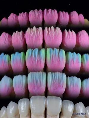 Αγορά The Joydenta Ceramic Veneer Process σε απευθείας σύνδεση κατασκευή