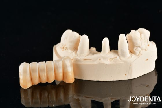 Αγορά Unveil True Biomimicry: Introducing Our Multi-Layered Zirconia Aesthetic Bridge σε απευθείας σύνδεση κατασκευή