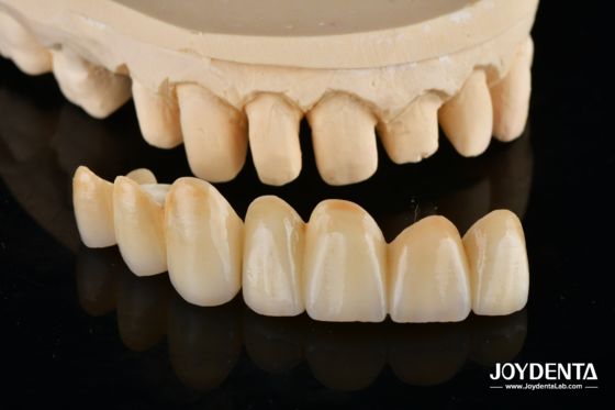 Αγορά Unveil True Biomimicry: Introducing Our Multi-Layered Zirconia Aesthetic Bridge σε απευθείας σύνδεση κατασκευή