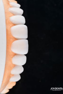 Αγορά Enhance Case Acceptance & Patient Communication with Our Diagnostic Wax-Up Service σε απευθείας σύνδεση κατασκευή