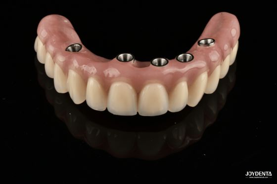 Αγορά Redefining Full Arch Prosthetics: Unmatched Fit and Function with Our Ti-Base Complete Dentures σε απευθείας σύνδεση κατασκευή