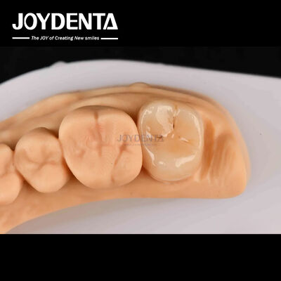 Αγορά Υψηλής αντοχής Emax Inlay Onlay A2 χρώμα μακροχρόνια για την αποκατάσταση των κατεστραμμένων δοντιών σε απευθείας σύνδεση κατασκευή