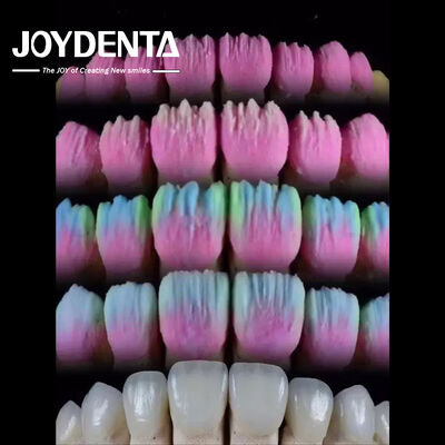 Αγορά The Joydenta Ceramic Veneer Process σε απευθείας σύνδεση κατασκευή