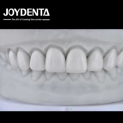 Αγορά Visualize the Result, Secure the Case: Our Diagnostic Wax-Up Service σε απευθείας σύνδεση κατασκευή