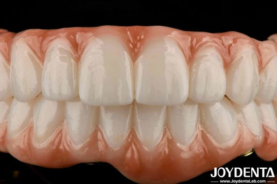 Μακροχρόνια Titanium Bar Zirconia Υβριδική Γέφυρα Φυσική εμφάνιση Αισθητική για αποκατάσταση