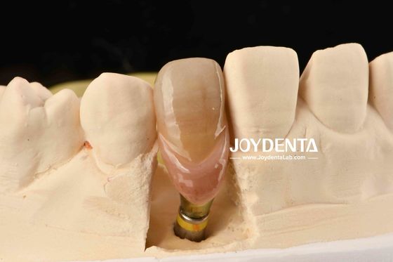 0° Γωνία Τελειωμένα οδοντικά πέλματα 1.5mm Τήχης Πίτσα Λουστρωμένη επιφάνεια