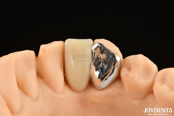 Ιδανική αντιστοίχιση Κλινική σύνδεση Maryland Dental Για Ορθή Κλινική Επισκευή Εργασία