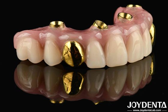 50ml Dentwre από τις Ηνωμένες Πολιτείες Η απόλυτη λύση σας Ti-Bar Ακρυλική Οδοντική Φινίρισμα για την οδοντιατρική θεραπεία