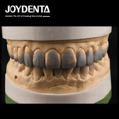 Προσωρινή χρήση Διαγνωστική κερί επάνω ομαλή υφή δόντια κερί επάνω Custom