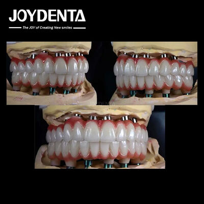 10 mm Τιτανίου Πολλαπλές οδοντικά εμφυτεύματα Ακατέργαστη επιφάνεια για την οδοντική αποκατάσταση