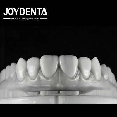 Φυσικό χρώμα οδοντικό κερί Πολυδιάστατη λύση για την αποκατάσταση ενός ή πολλών δοντιών